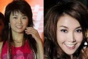 爆料娱乐圈整容艺人,揭秘那些曾整容的明星，容貌巨变背后的真相