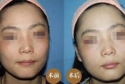 徒手祛斑爆料视频大全,视频大全带你轻松告别斑点困扰